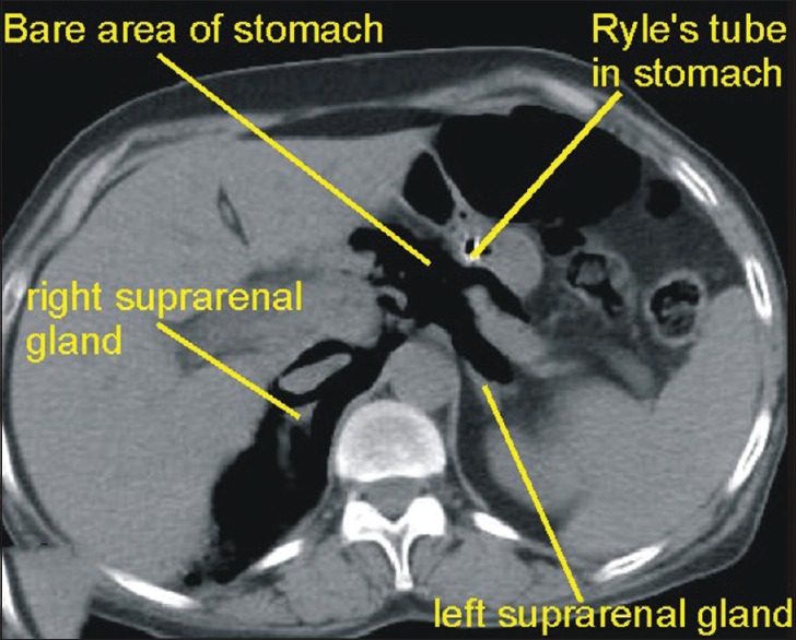 Figure 39