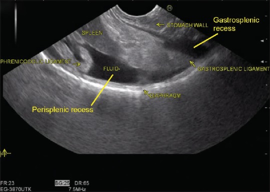 Figure 33