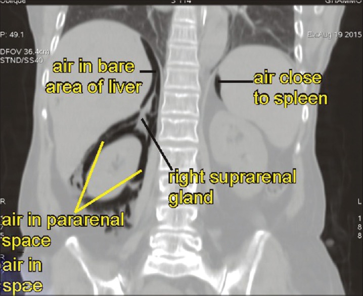 Figure 37