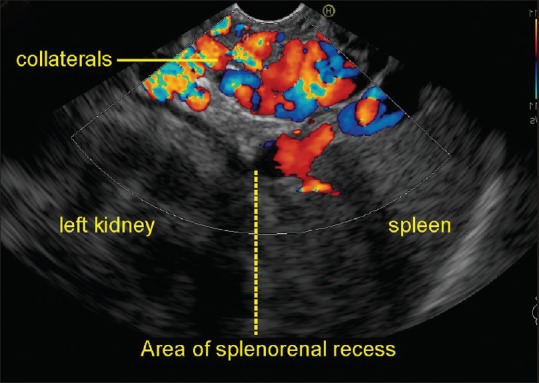 Figure 30