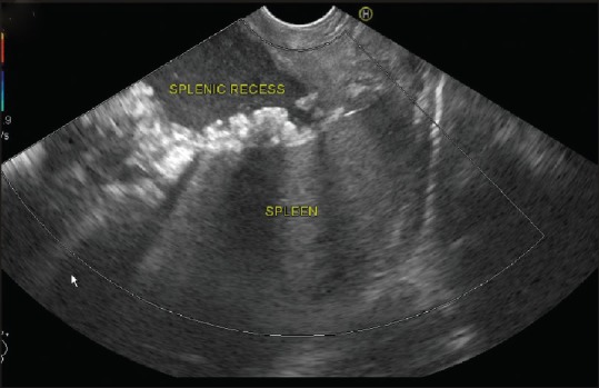 Figure 23