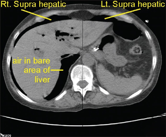 Figure 34