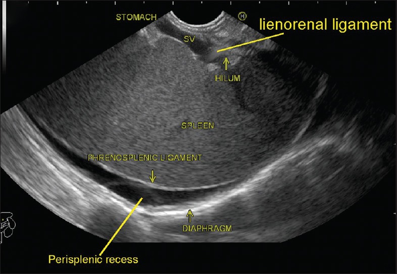 Figure 32