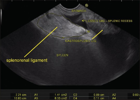 Figure 31