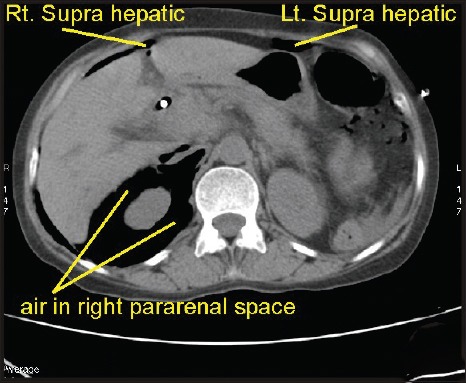 Figure 35