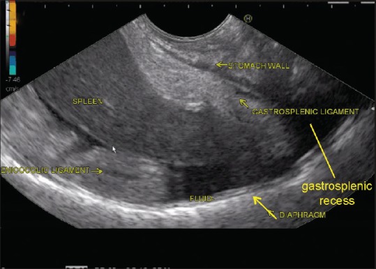 Figure 15