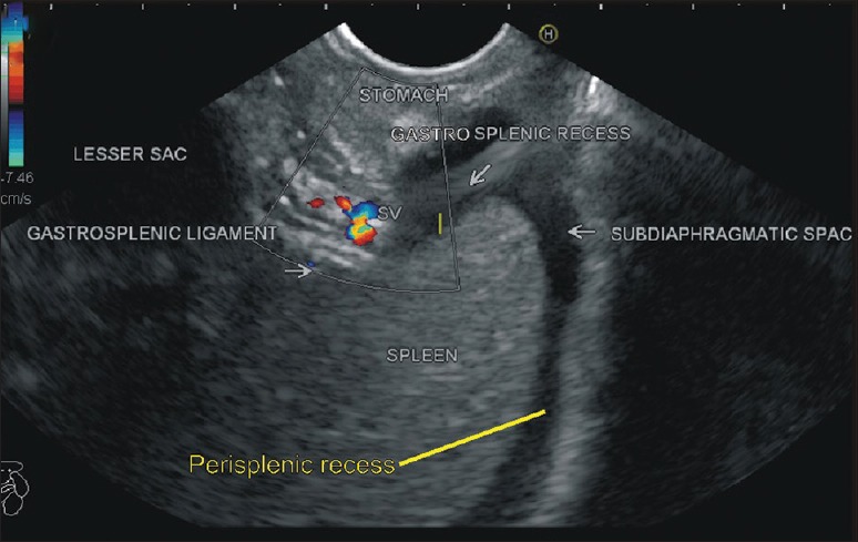 Figure 27