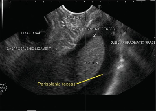 Figure 26