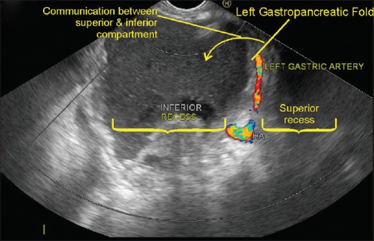 Figure 19