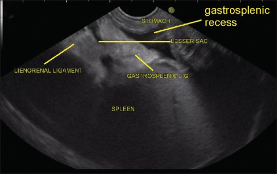 Figure 28