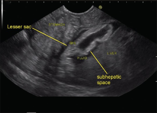 Figure 17