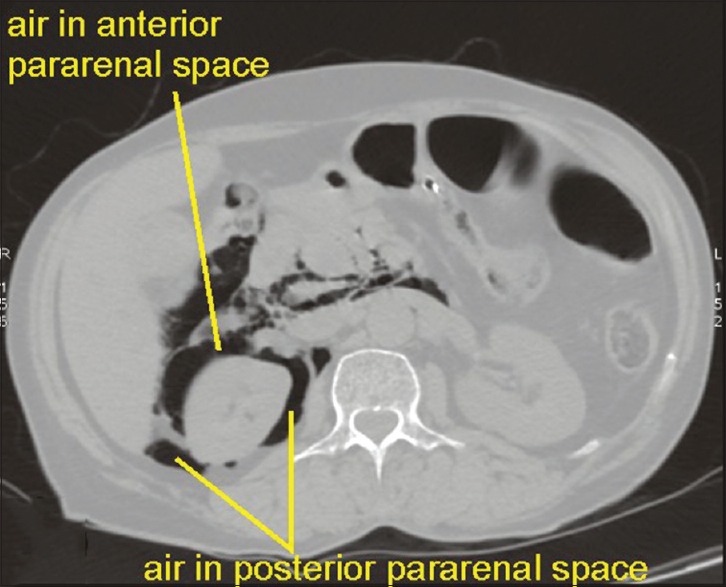 Figure 38