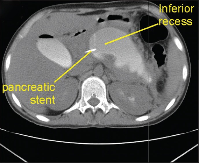 Figure 25