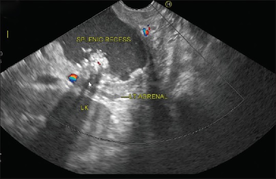 Figure 24