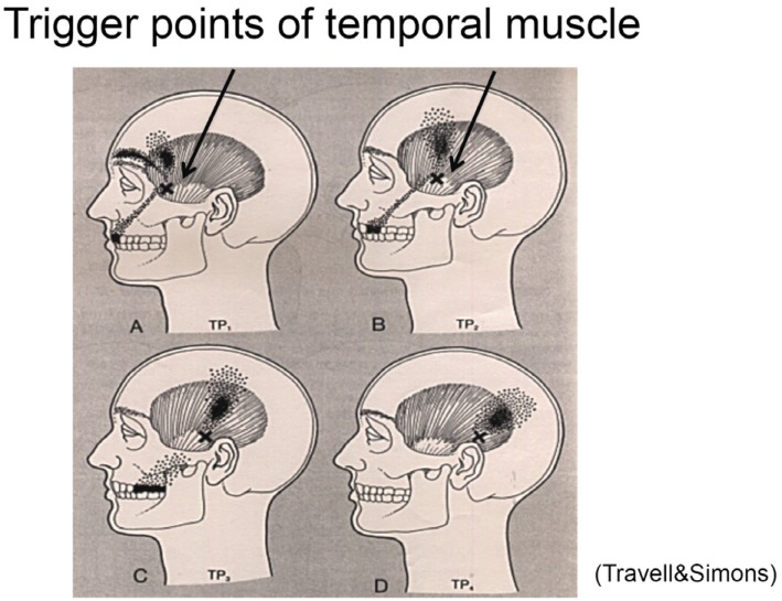 Fig. 11