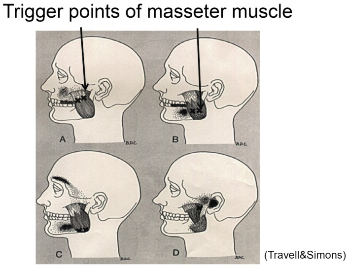 Fig. 10