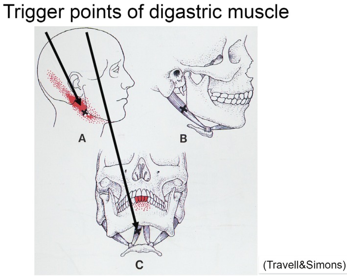 Fig. 12