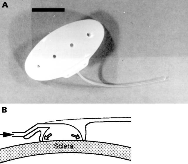 Figure 3  