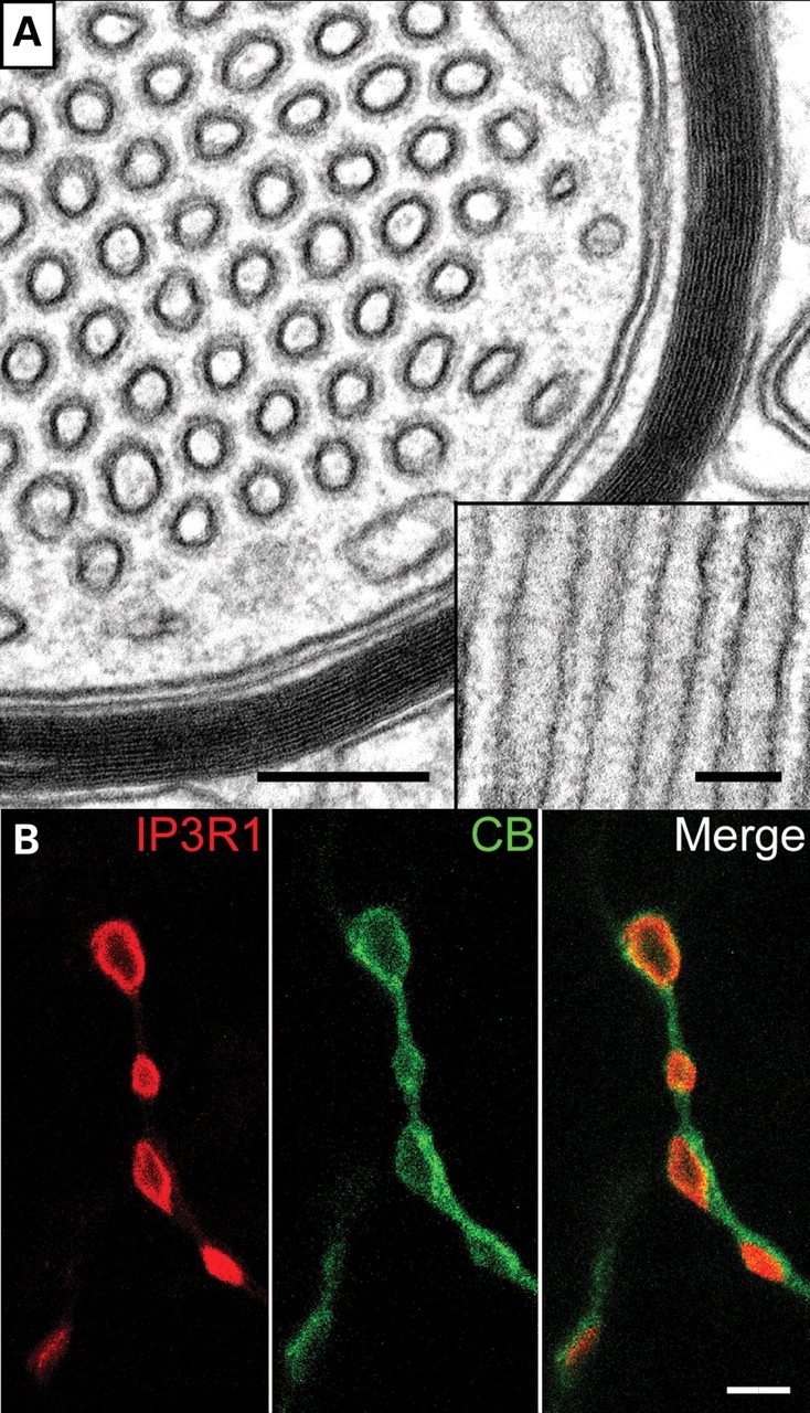 Figure 11.