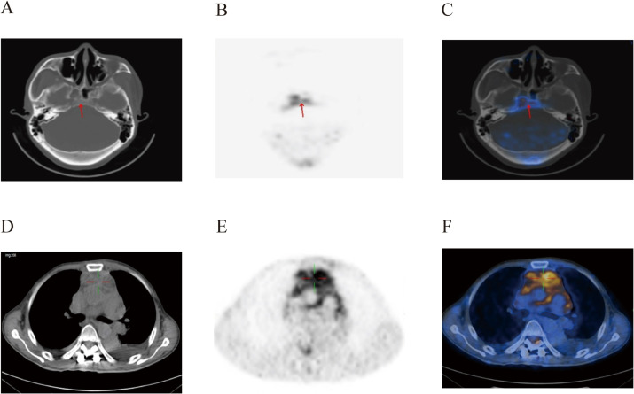 Figure 2