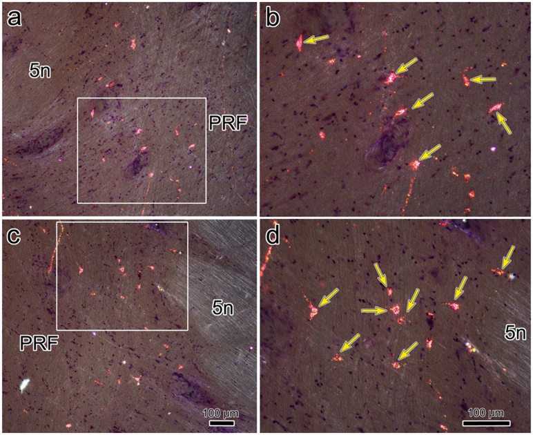 Figure 13.