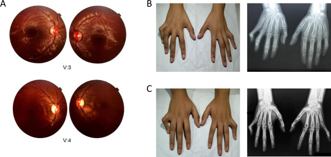 Fig. 2