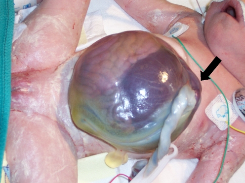 Fig. 1