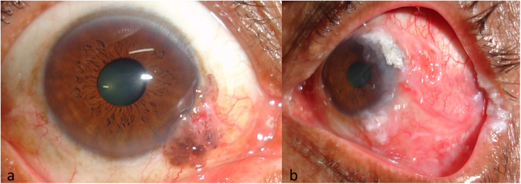 Fig.1