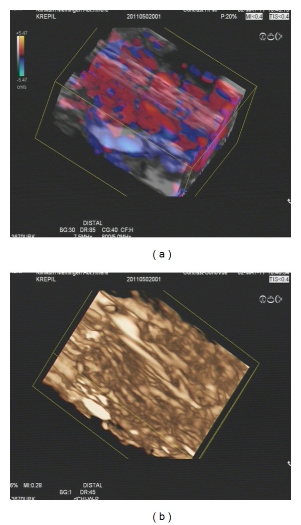 Figure 4