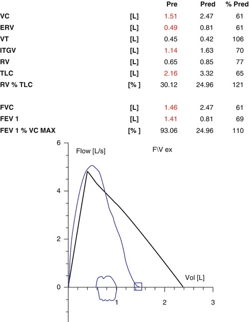 Fig. 4.13