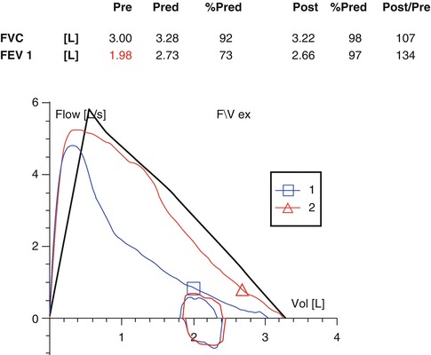 Fig. 4.14