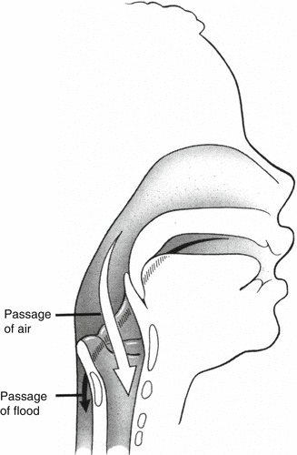 Fig. 4.3