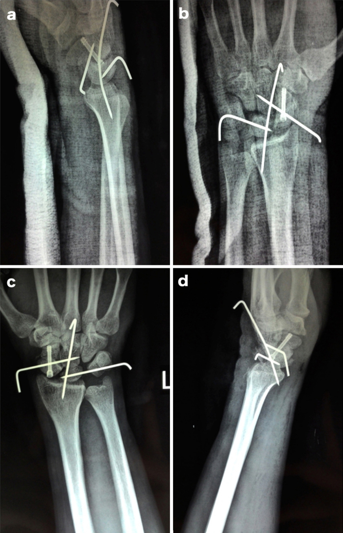 Fig. 3