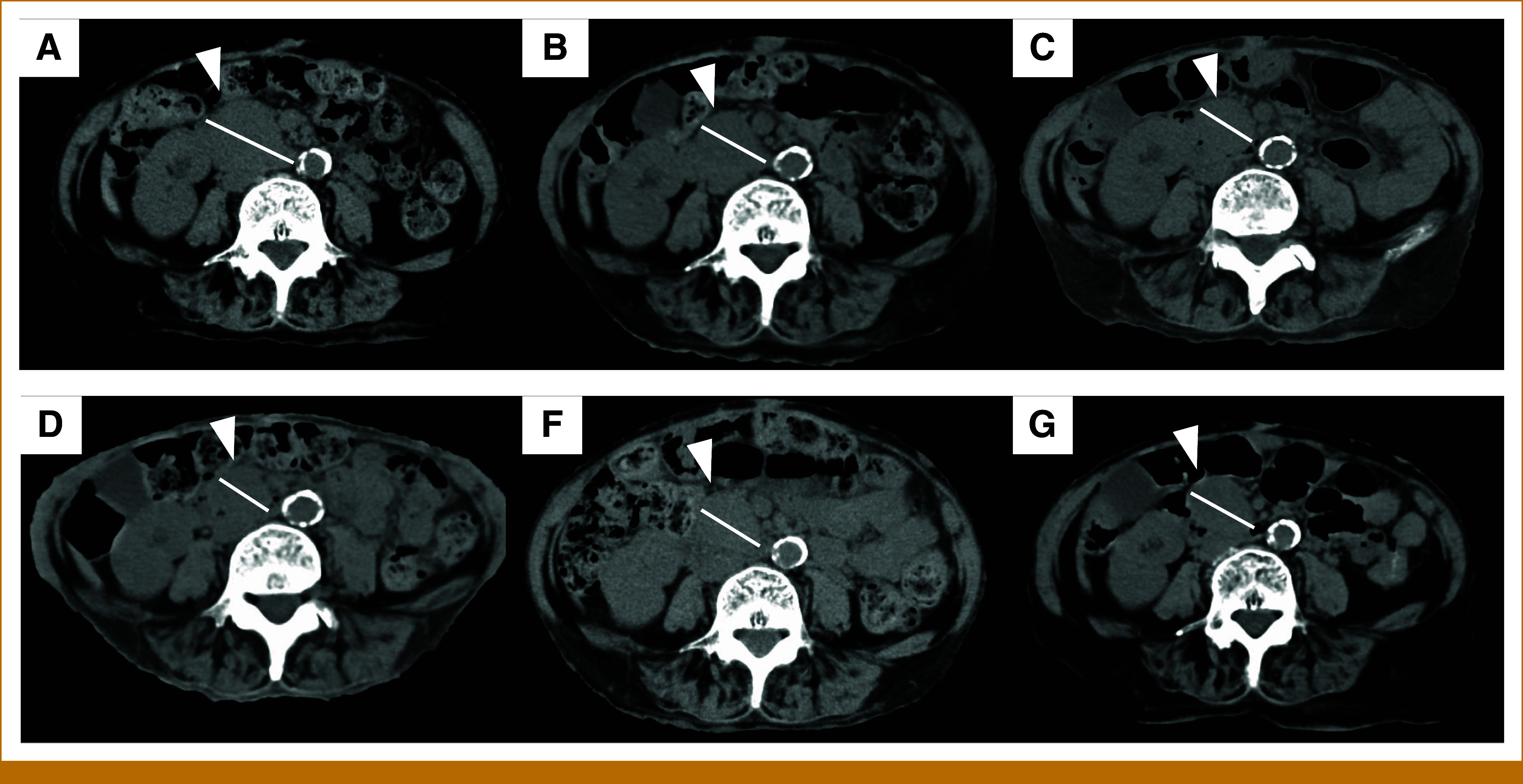 FIG 1.