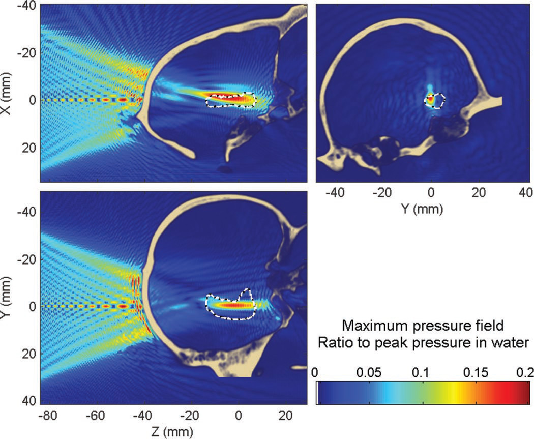 Fig. 10