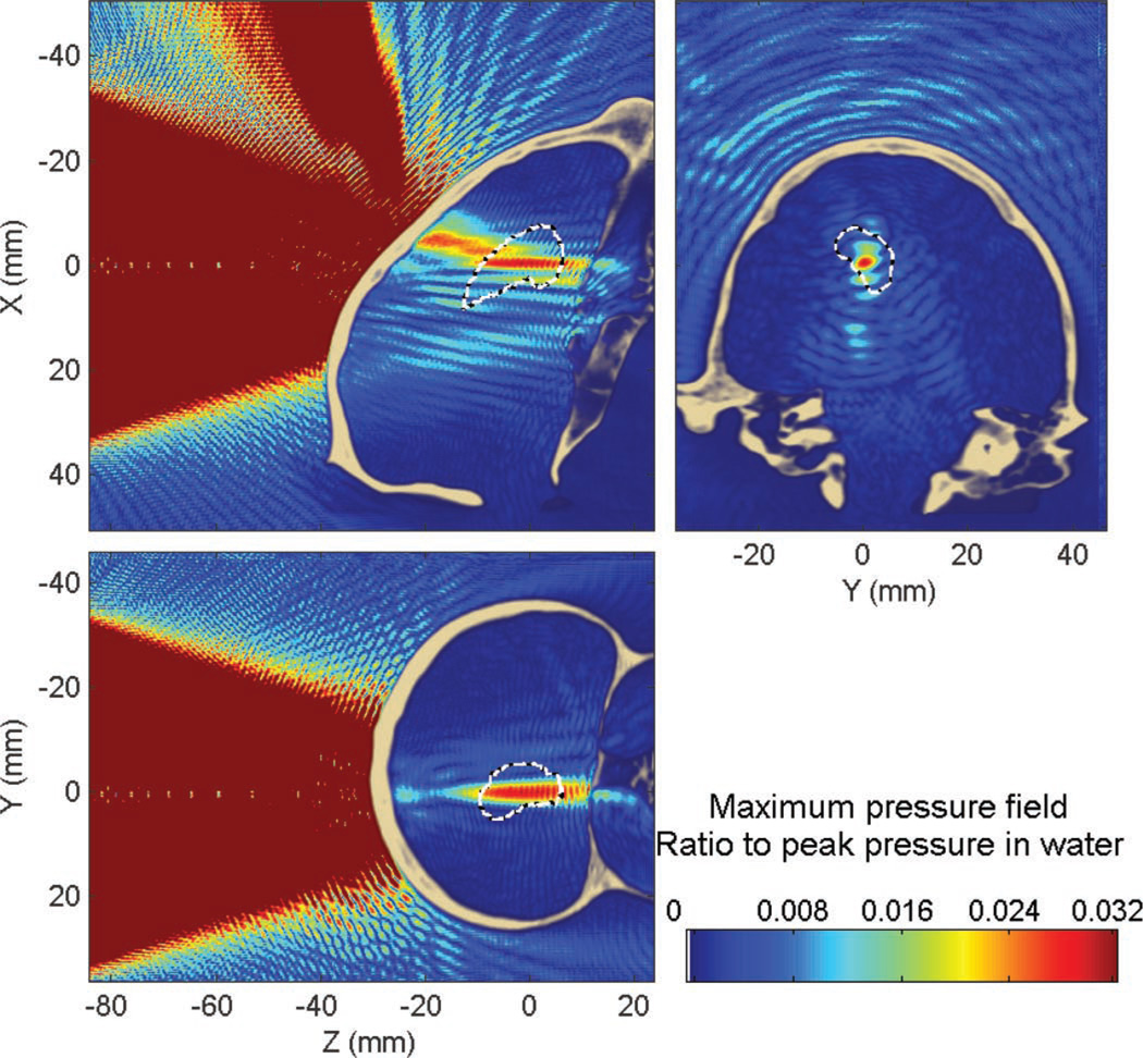 Fig. 13