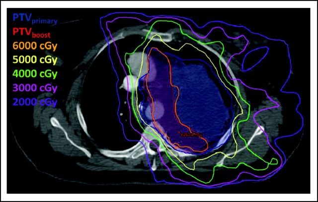 Fig 3.