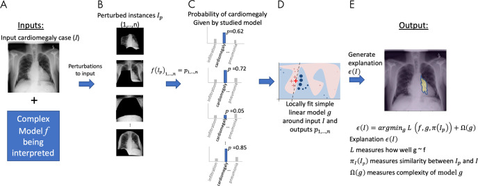 A, Local interpretable model-agnostic explanations (LIME) method approximates a complex model f (eg, a neural network) with a simplified model g (eg, linear model) around the input case I being interpreted. B, Perturbed instances (Ip)1,...,n are produced, and C, predictions f(Ip)1,...,n = p1,...,n are obtained. D, The similarity πI(Ip)1,...,n between the input image I and each perturbed instance (Ip)1,...,n is measured, and these values are used as weights to fit a simpler (eg, linear) model g, in a weighted fashion. The size of red crosses and blue circles illustrates weights. E, An explanation, ϵ(I), is generated by minimizing the disagreement between f and g (ie, how well g approximates f) while keeping the complexity of model g, as measured by Ω(g), low. Note: Perturbations can be of any type; in this example, image regions are blacked out. The similarity metric πI as well as the model g can be selected by the user.