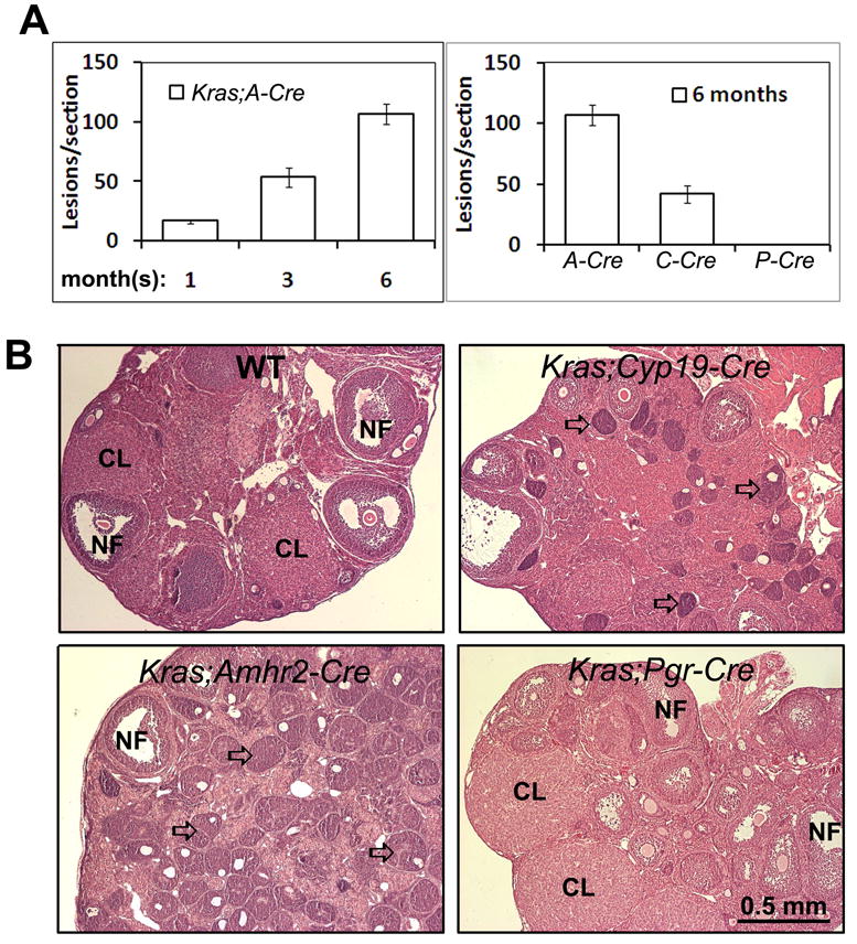 Cell Type Specific Targeted Mutations Of Kras And Pten Document