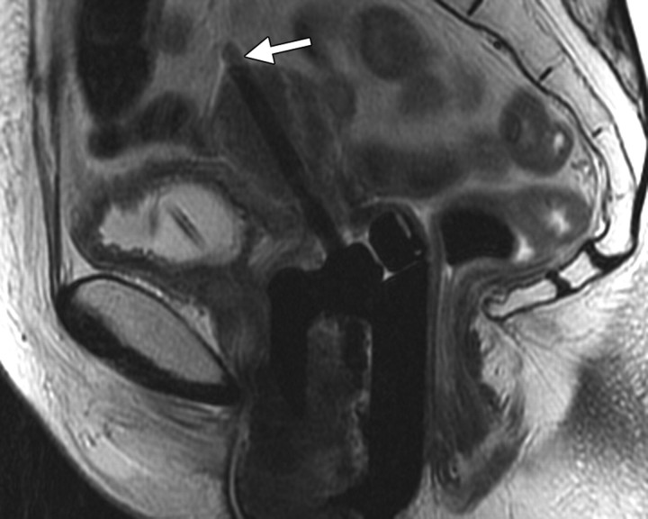 Figure 1b