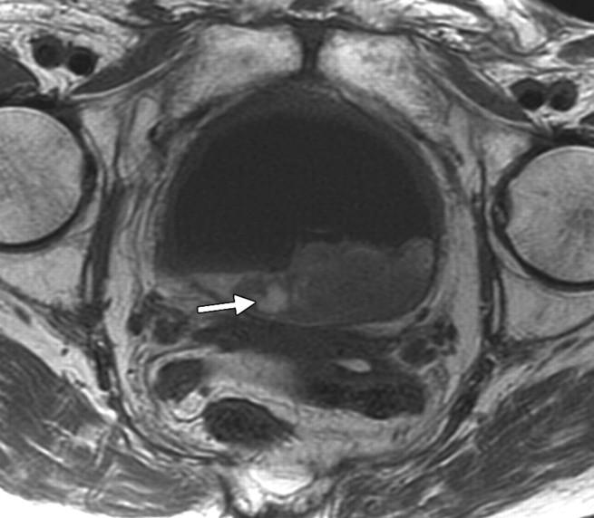 Figure 13b