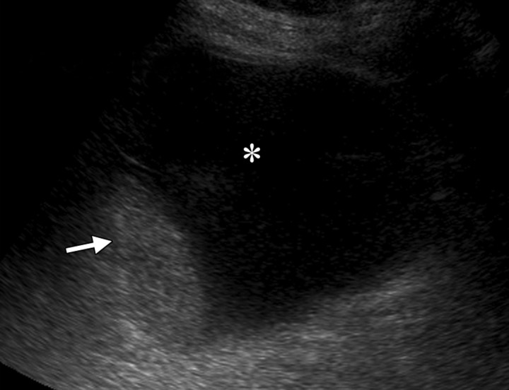 Figure 14b