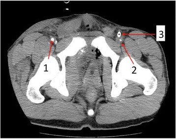 Fig. 3