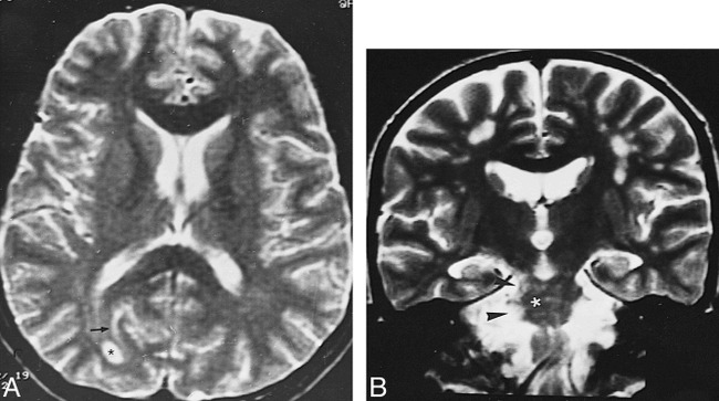 fig 6.