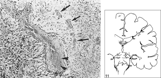 fig 10.