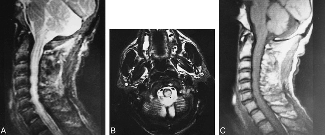 fig 5.