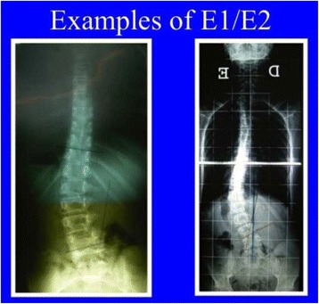 Fig. 37