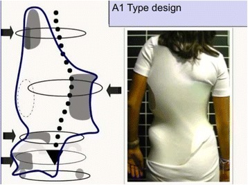 Fig. 39