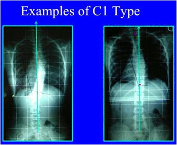 Fig. 32