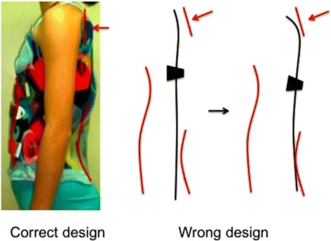 Fig. 16